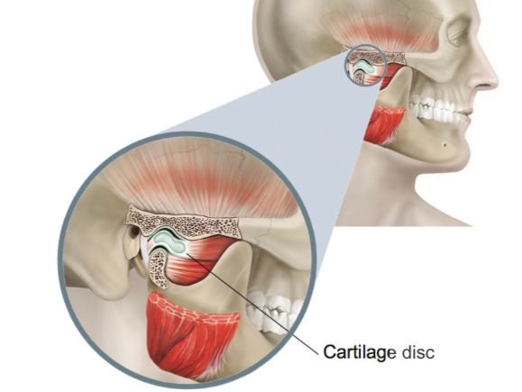 Facial Surgery